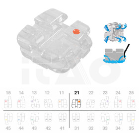 Brackets DB Agility Ceramic Roth .022'' UL1 5pz.