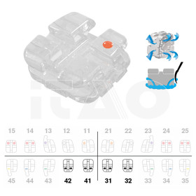 Brackets DB Agility Ceramic...