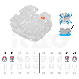 Brackets DB Vapor MBT .022"...