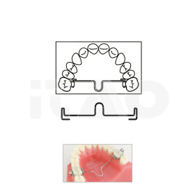 Barre palatali distali 52mm cf 5pz