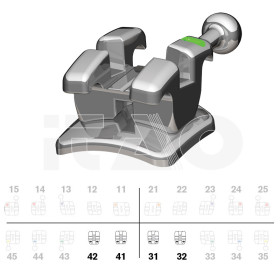 Brackets DB miniPrevail VS...