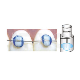 Mini Mold Brackets Bonder 10pz.