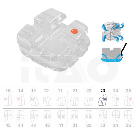 Brackets DB Agility Ceramic...